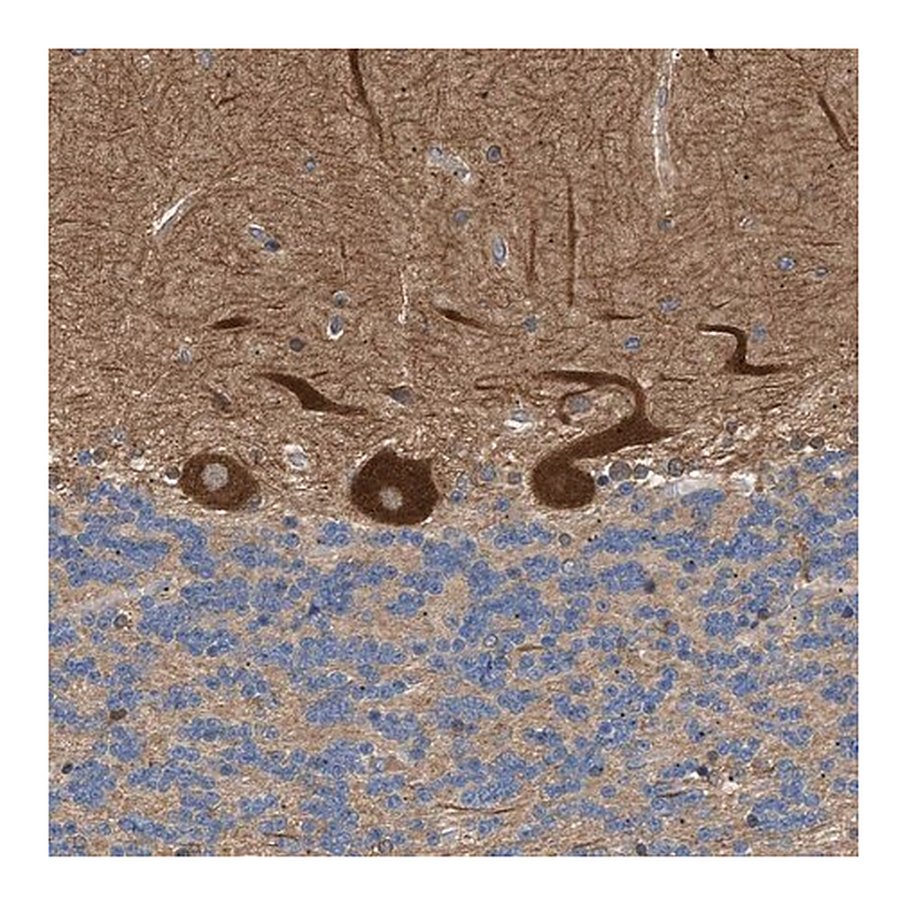 Merck Anti-PPM1B antibody produced in rabbit