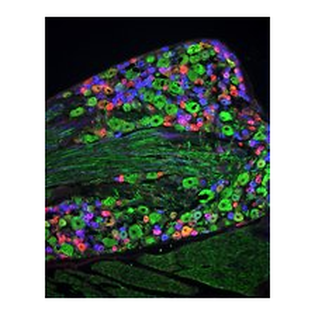 Merck ANTI-NEUROFILAMENT 160/200 ANTIBODY, MO&