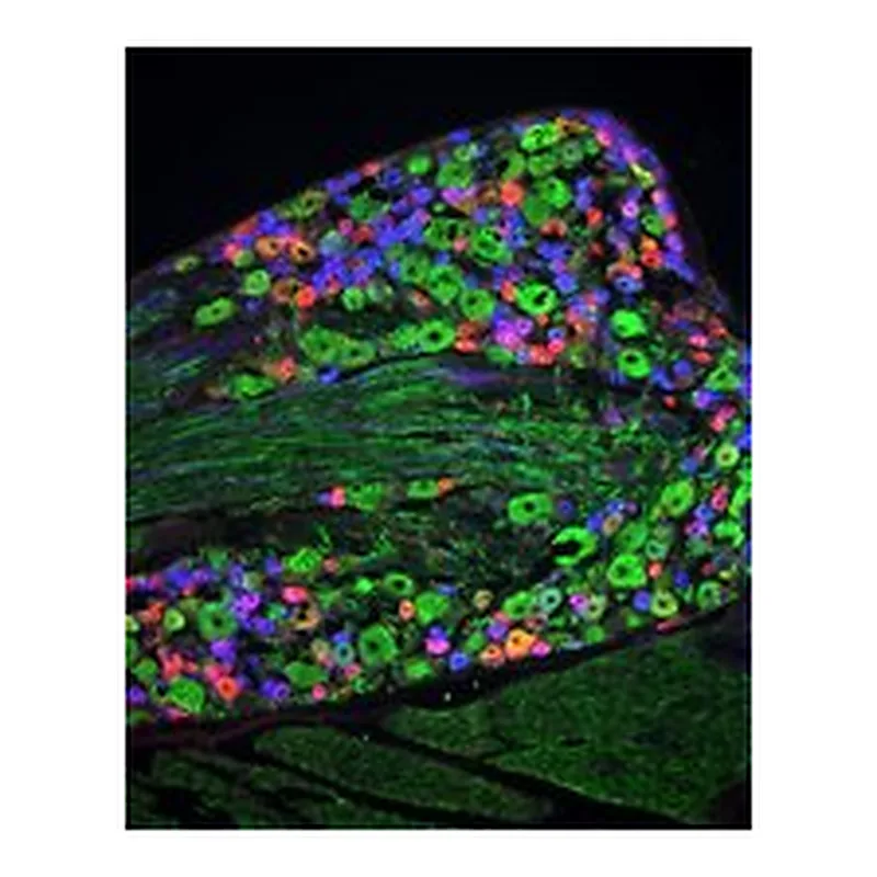 Merck ANTI-NEUROFILAMENT 160/200 ANTIBODY, MO&