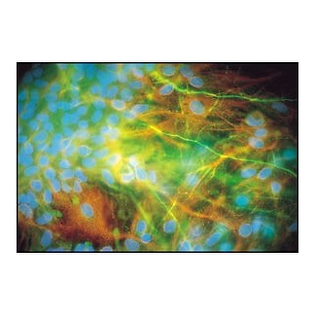 Merck RABBIT ANTI-NEUROFILAMENT 200