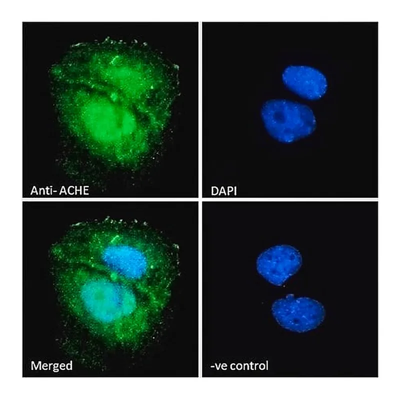 Merck Anti-ACHE antibody produced in goat