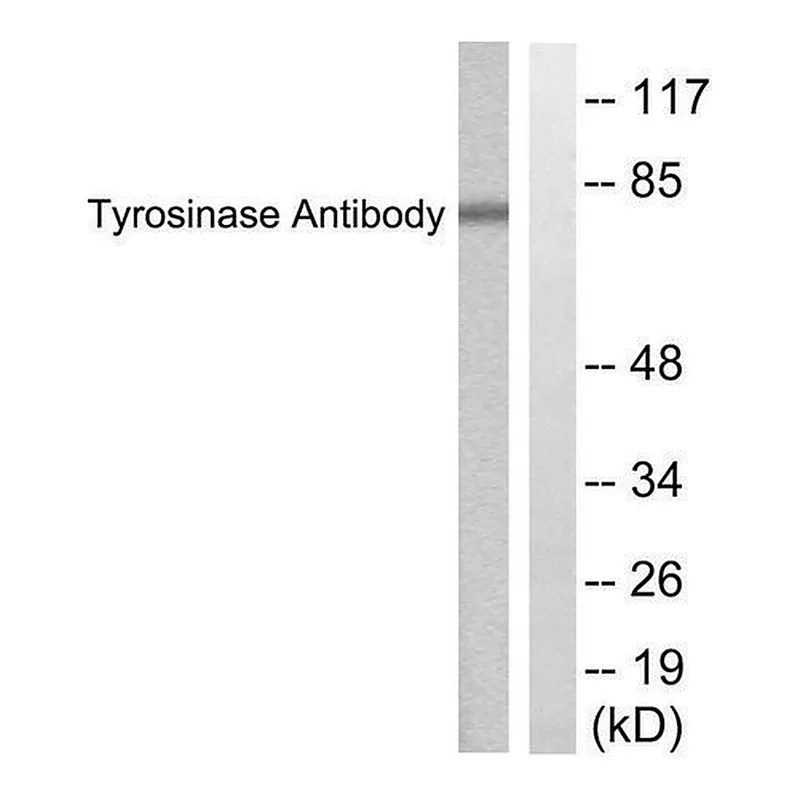 Merck Anti-Tyrosinase antibody produced in rabbit
