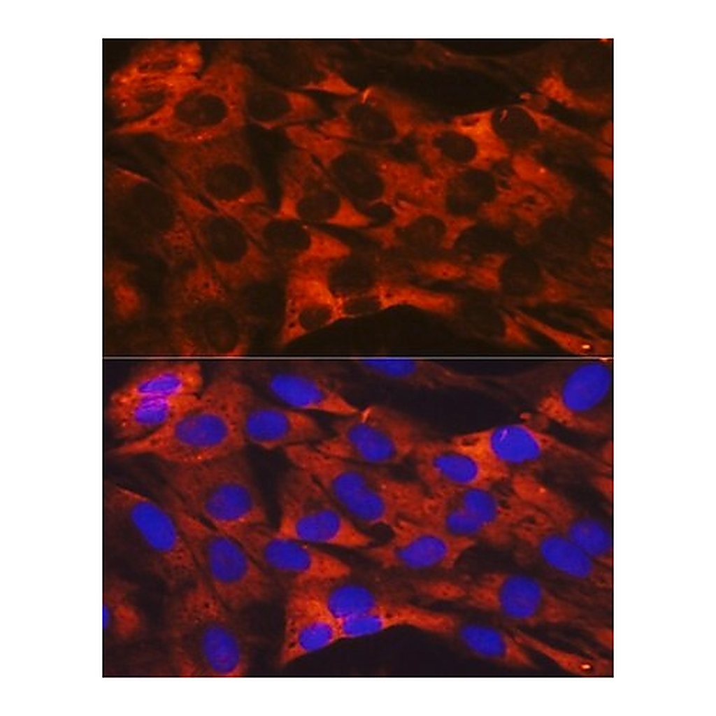 Merck Anti-RPS19 antibody produced in rabbit