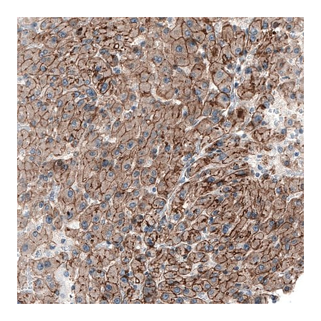 Merck Anti-MYO1B antibody produced in rabbit