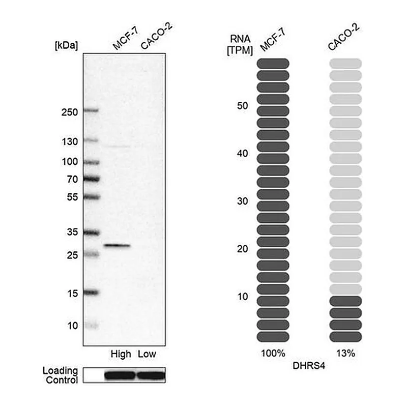 Merck Anti-DHRS4 antibody produced in rabbit