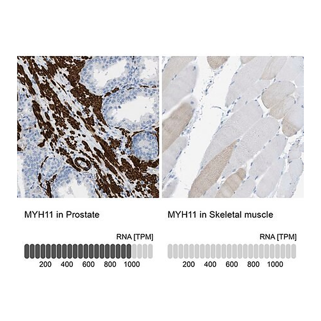 Merck Anti-MYH11 antibody produced in rabbit