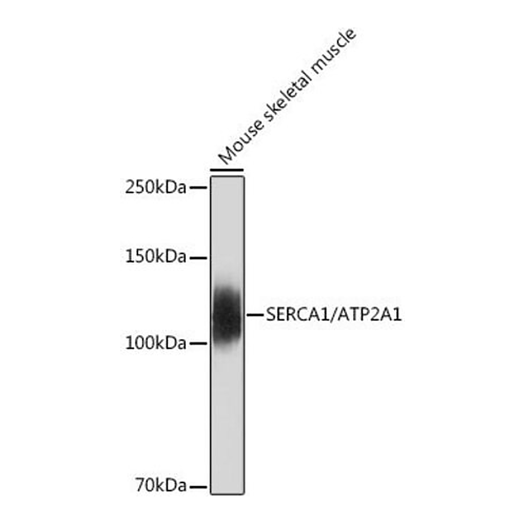 Merck Anti-SERCA1/ATP2A1 antibody produced in rabbit