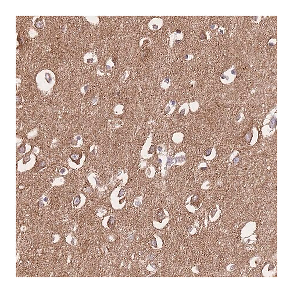 Merck Anti-FKBP8 antibody produced in rabbit