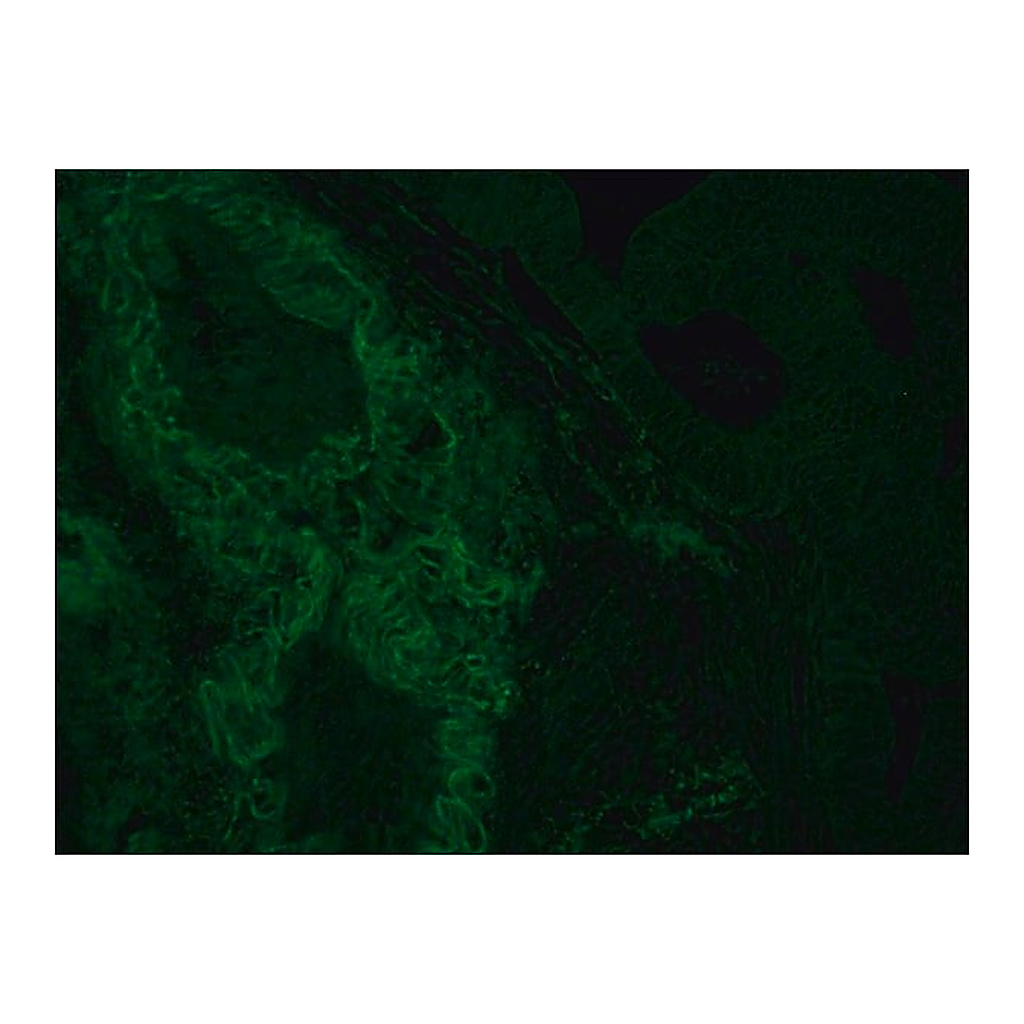 Merck Monoclonal Anti-HLA Class I Antigen-FITC antibody produced in mouse