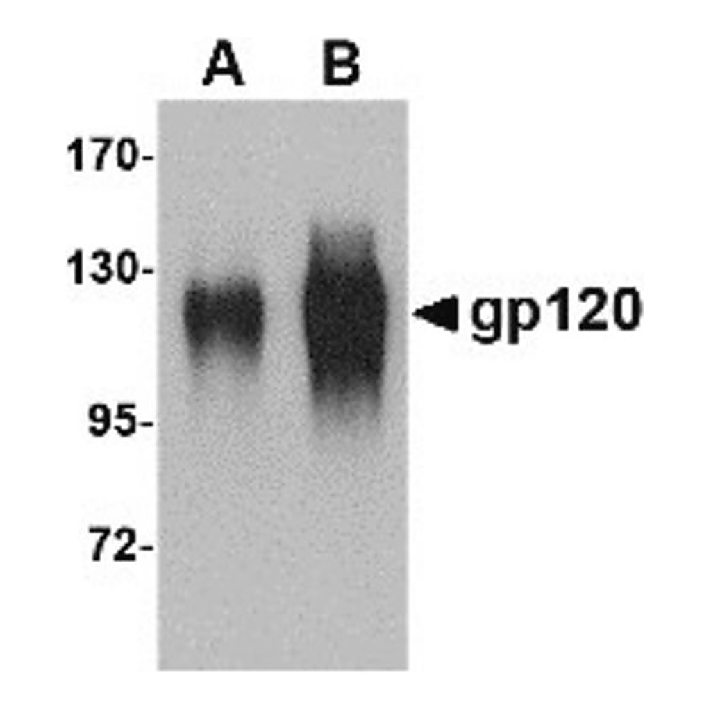 Merck Anti-gp120 antibody produced in goat