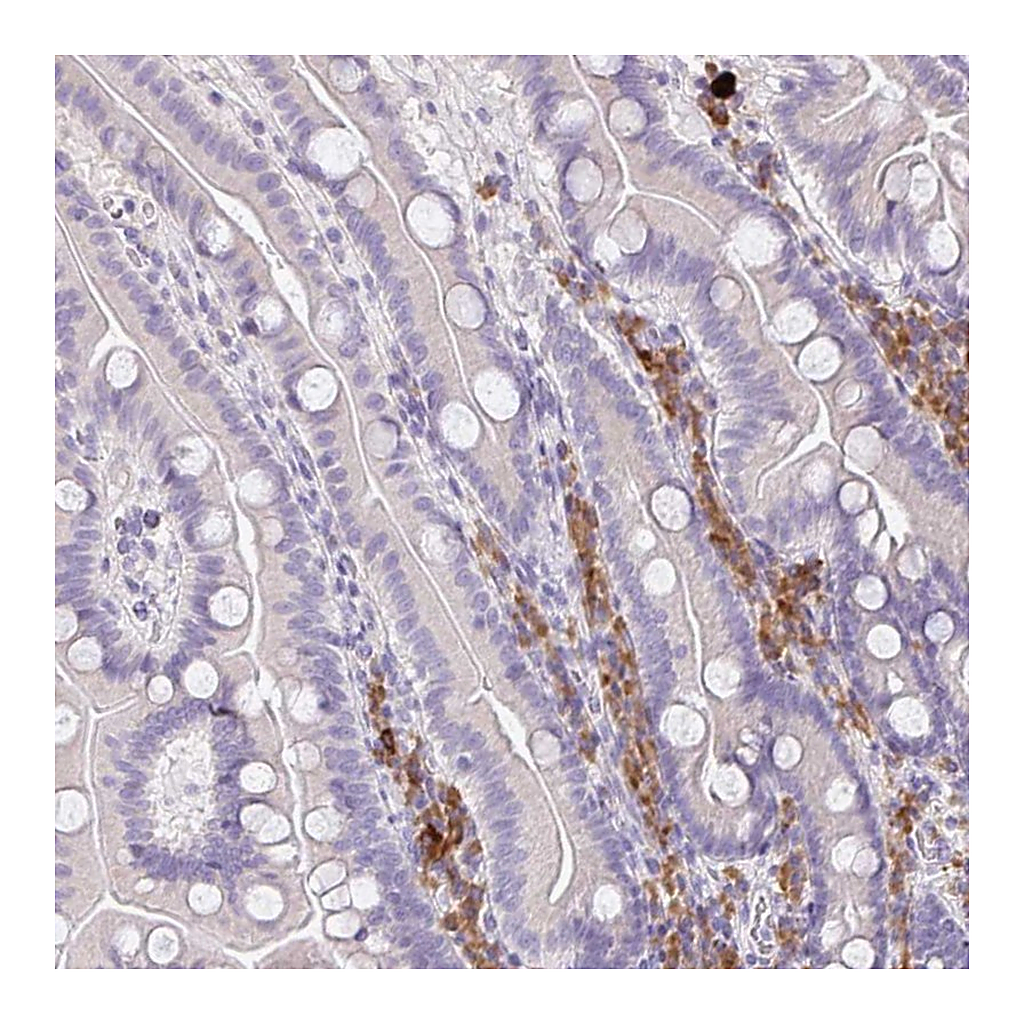 Atlas Antibodies Anti-ZNF215 Antibody