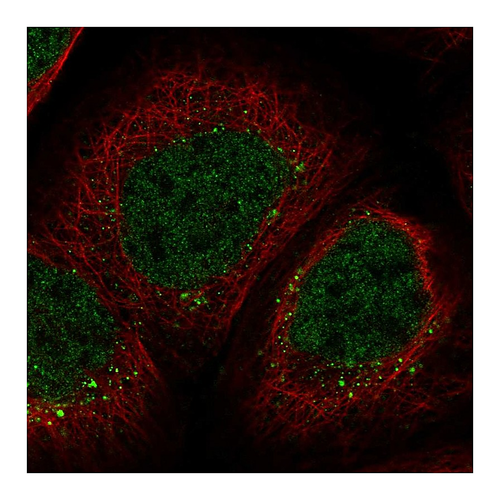 Atlas Antibodies Anti-ZNF213 Antibody
