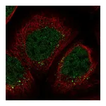 Atlas Antibodies Anti-ZNF213 Antibody