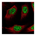 Atlas Antibodies Anti-ZNF217 Antibody