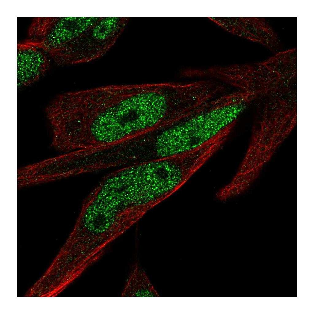 Atlas Antibodies Anti-ZNF225 Antibody