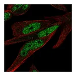 Atlas Antibodies Anti-ZNF225 Antibody