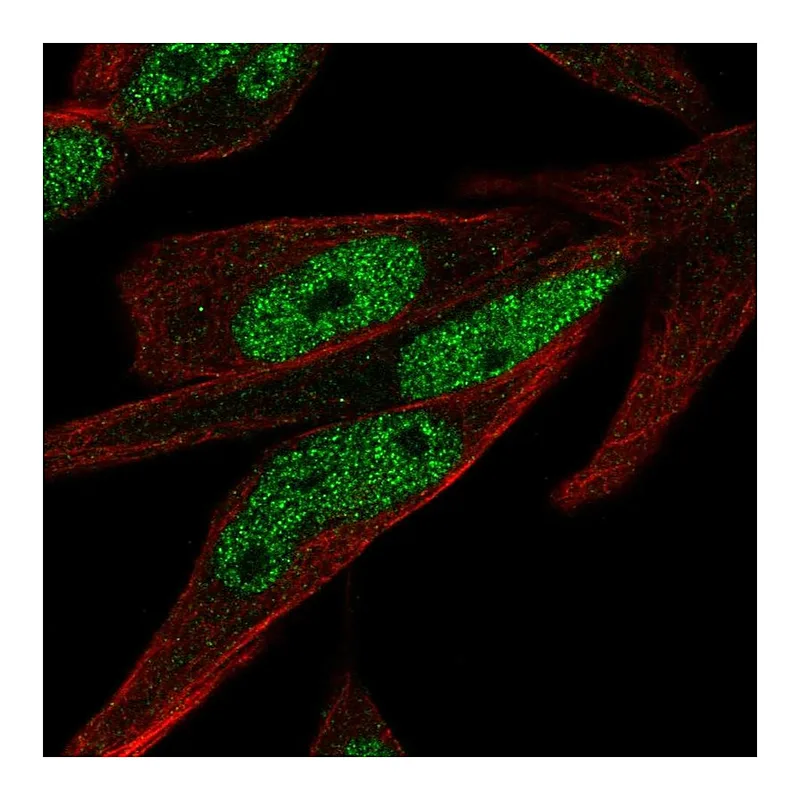 Atlas Antibodies Anti-ZNF225 Antibody
