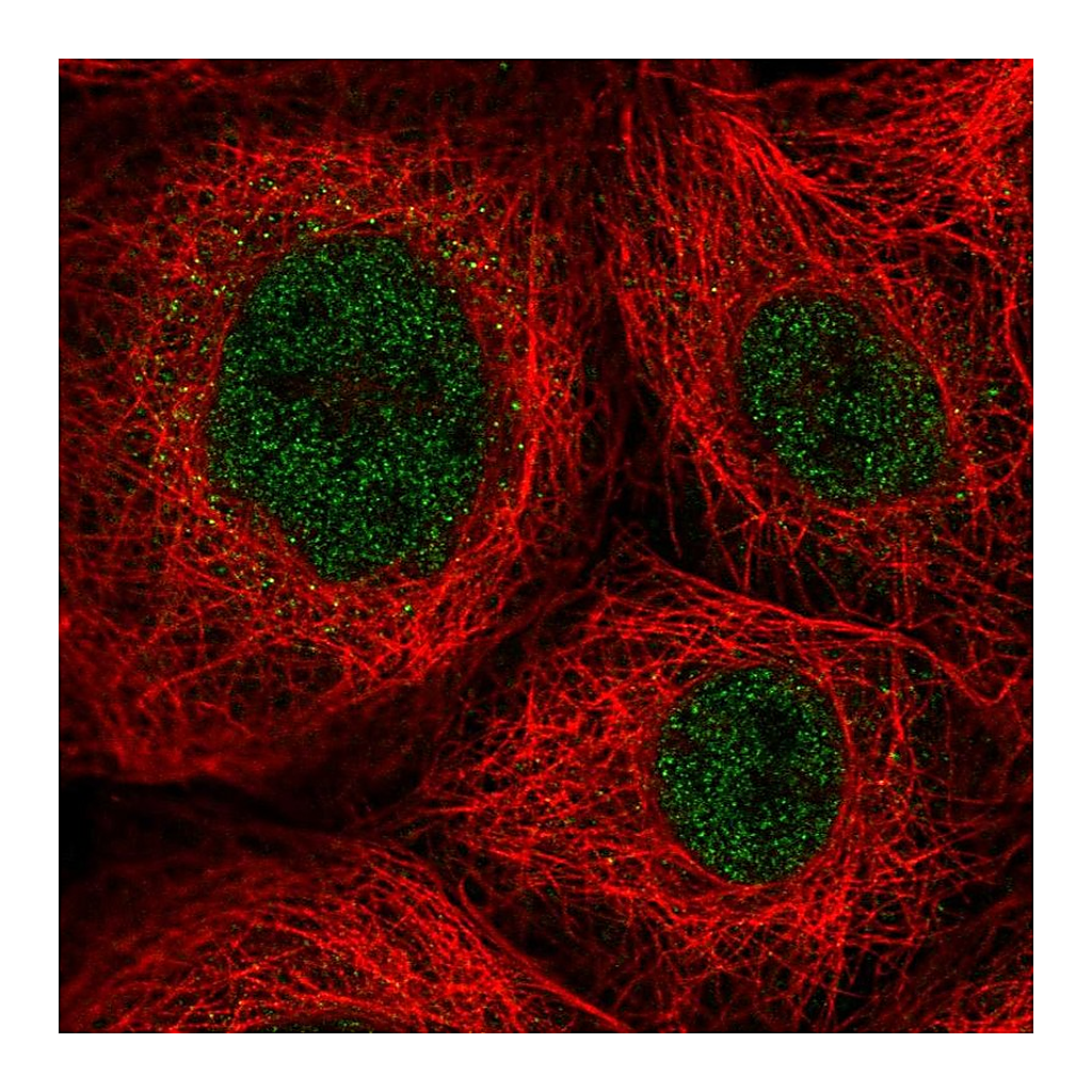 Atlas Antibodies Anti-ZNF22 Antibody