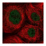 Atlas Antibodies Anti-ZNF22 Antibody