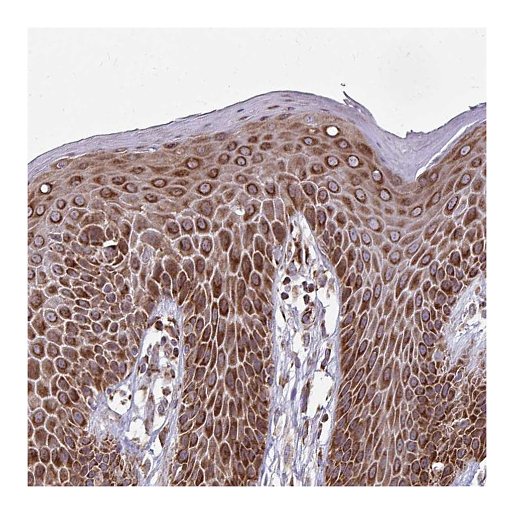 Atlas Antibodies Anti-ZNF219 Antibody
