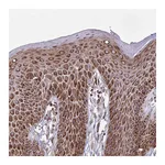 Atlas Antibodies Anti-ZNF219 Antibody