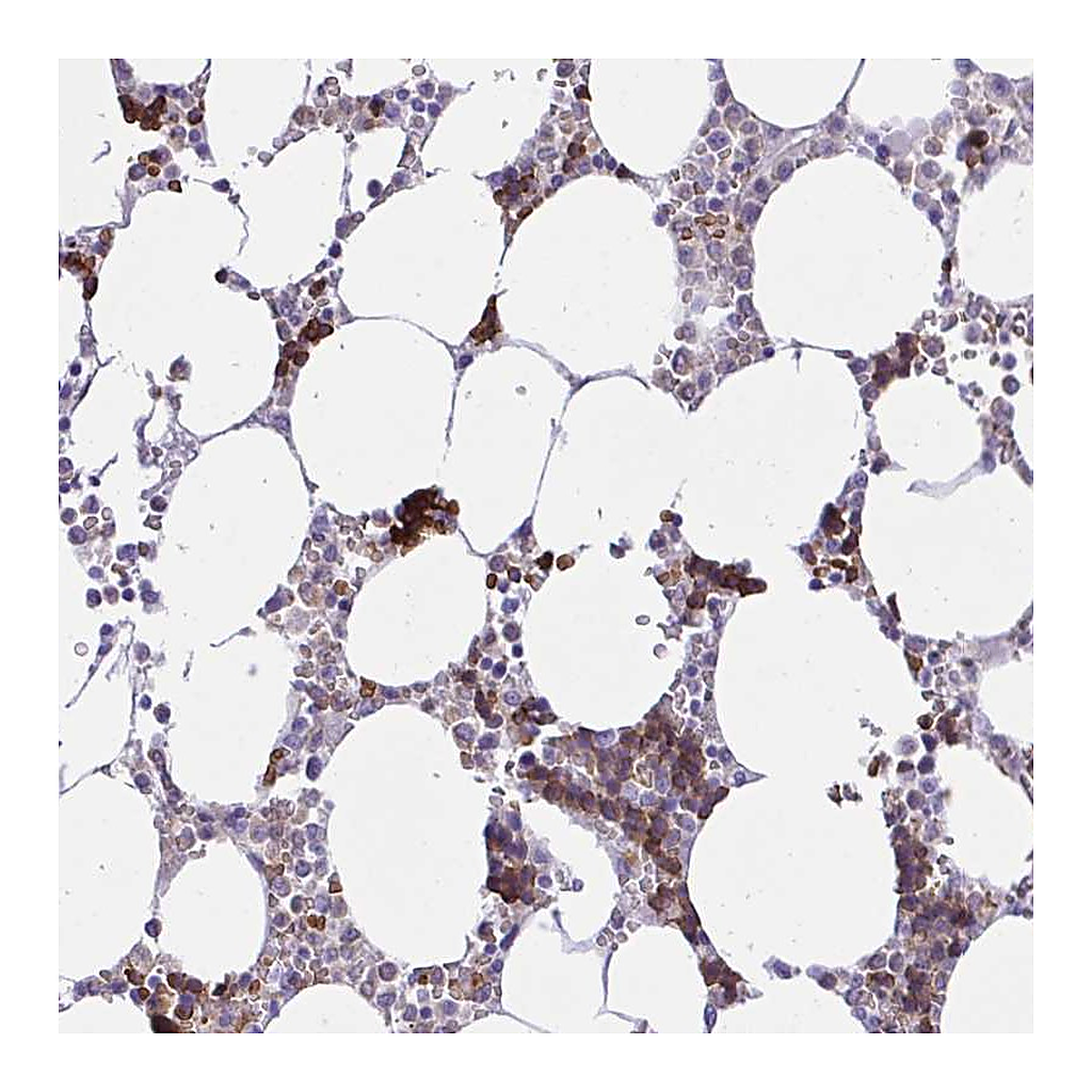 Atlas Antibodies Anti-ZNF221 Antibody