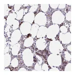 Atlas Antibodies Anti-ZNF221 Antibody