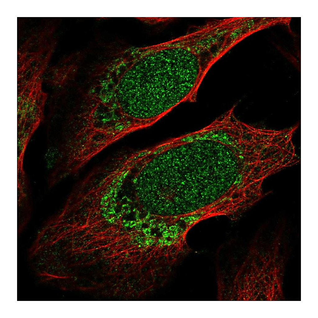Atlas Antibodies Anti-ZNF223 Antibody