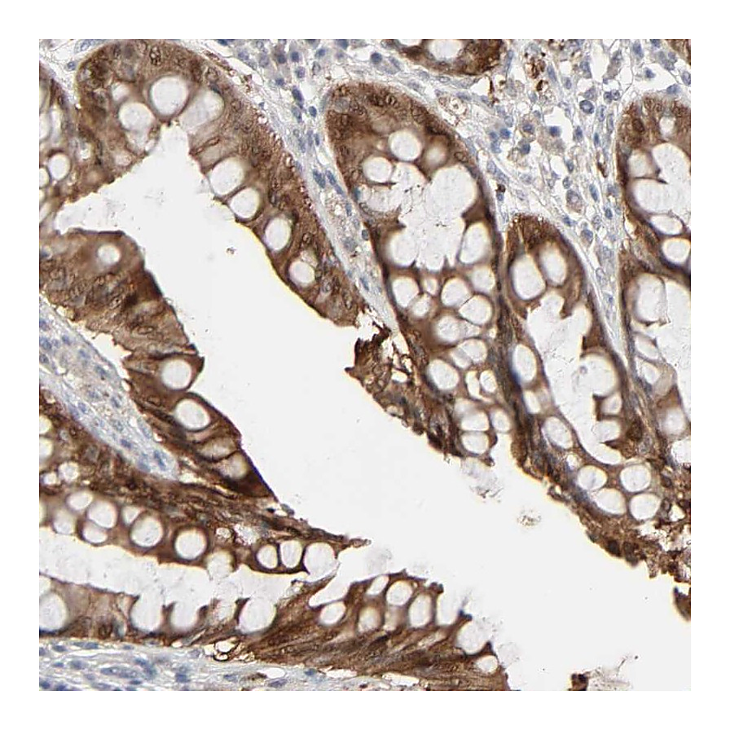 Atlas Antibodies Anti-ZNF222 Antibody