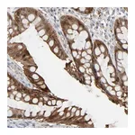 Atlas Antibodies Anti-ZNF222 Antibody