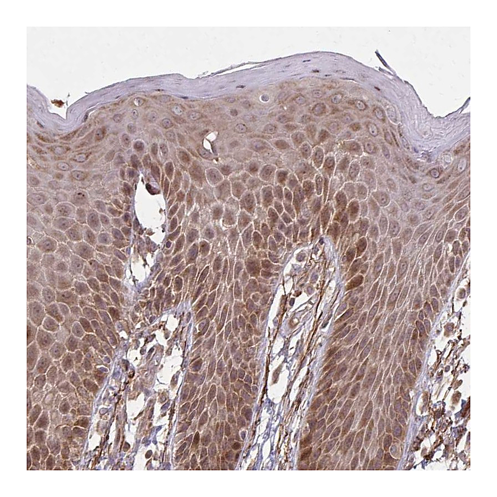 Atlas Antibodies Anti-ZNF219 Antibody