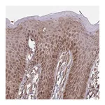 Atlas Antibodies Anti-ZNF219 Antibody