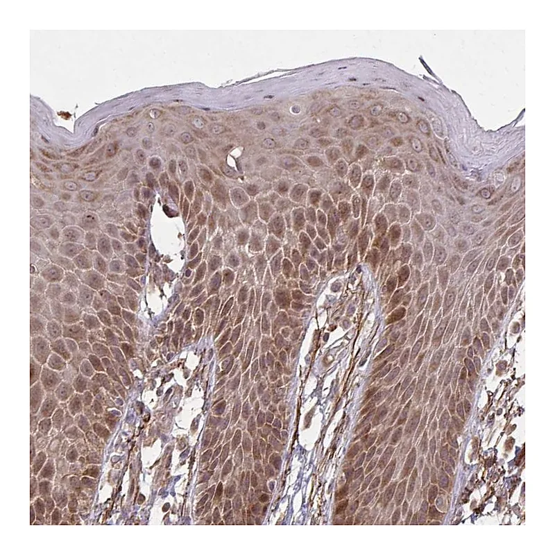 Atlas Antibodies Anti-ZNF219 Antibody