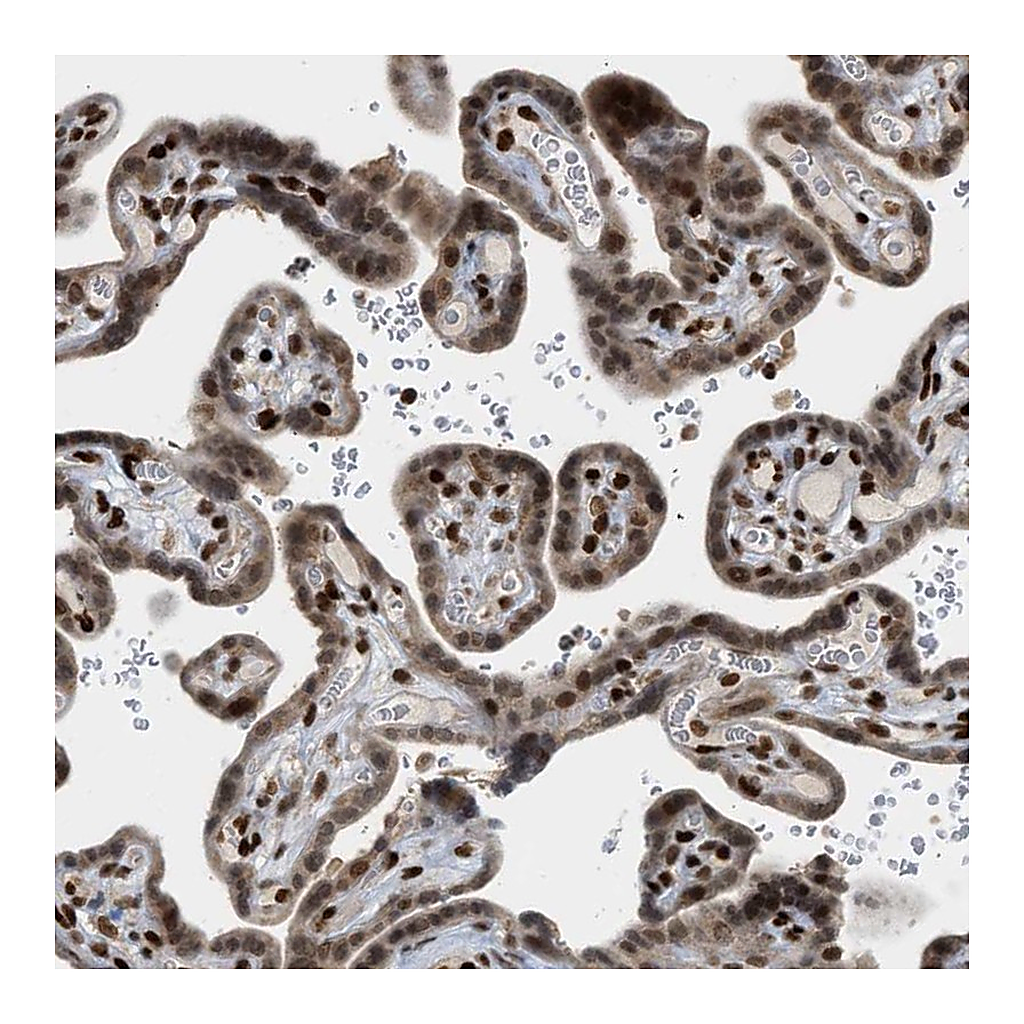 Atlas Antibodies Anti-ZNF22 Antibody