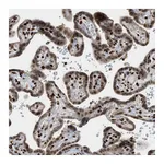 Atlas Antibodies Anti-ZNF22 Antibody