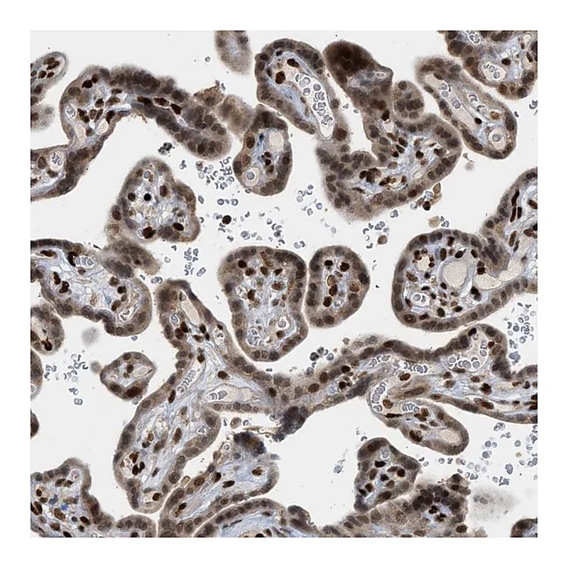 Atlas Antibodies Anti-ZNF22 Antibody
