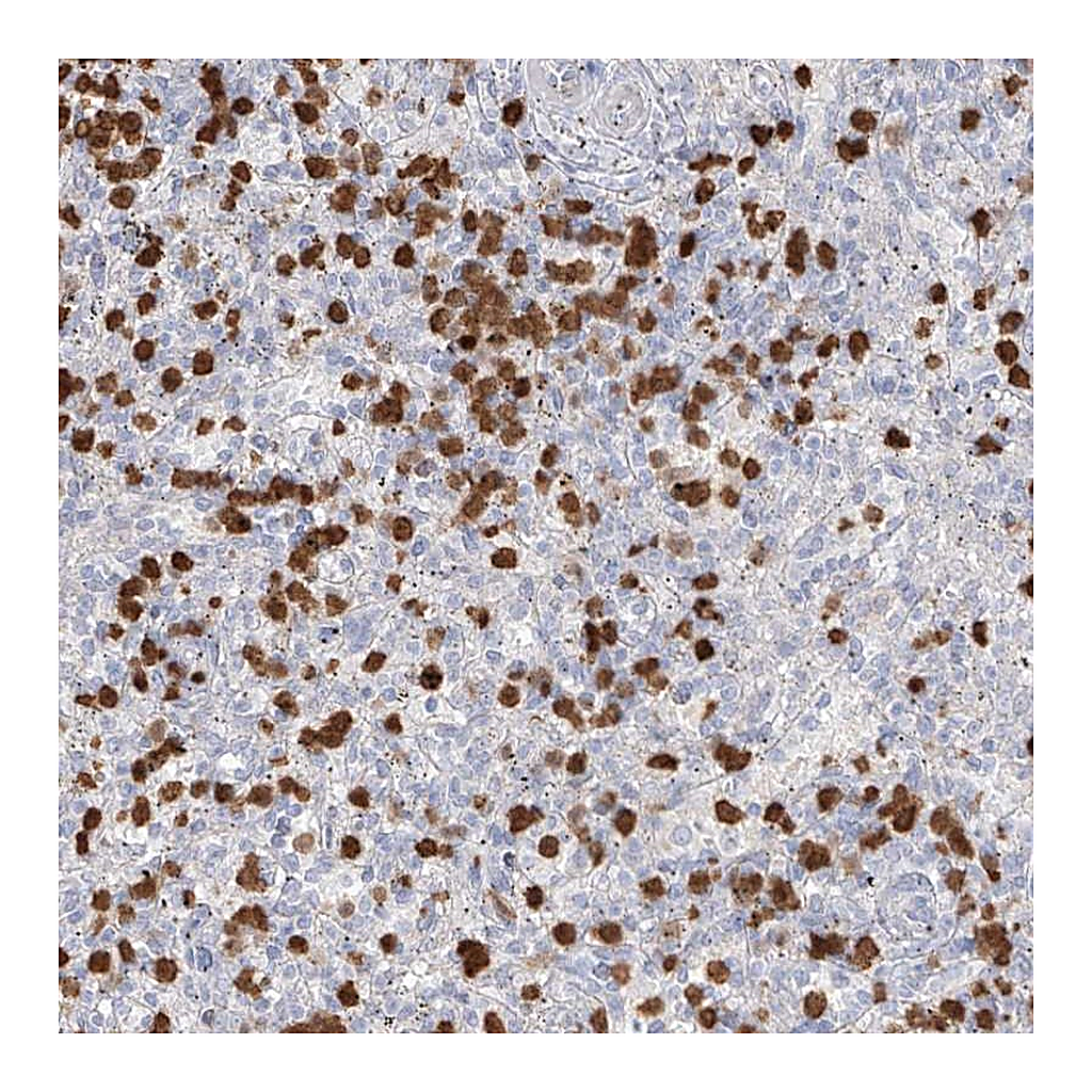 Atlas Antibodies Anti-ZNF227 Antibody