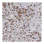 Atlas Antibodies Anti-ZNF227 Antibody