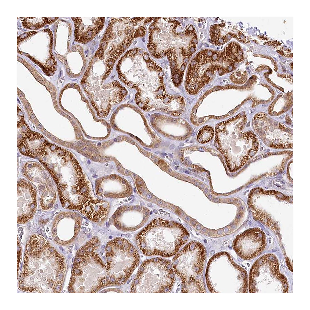Atlas Antibodies Anti-ZNF226 Antibody
