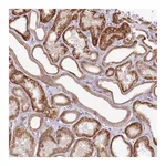 Atlas Antibodies Anti-ZNF226 Antibody