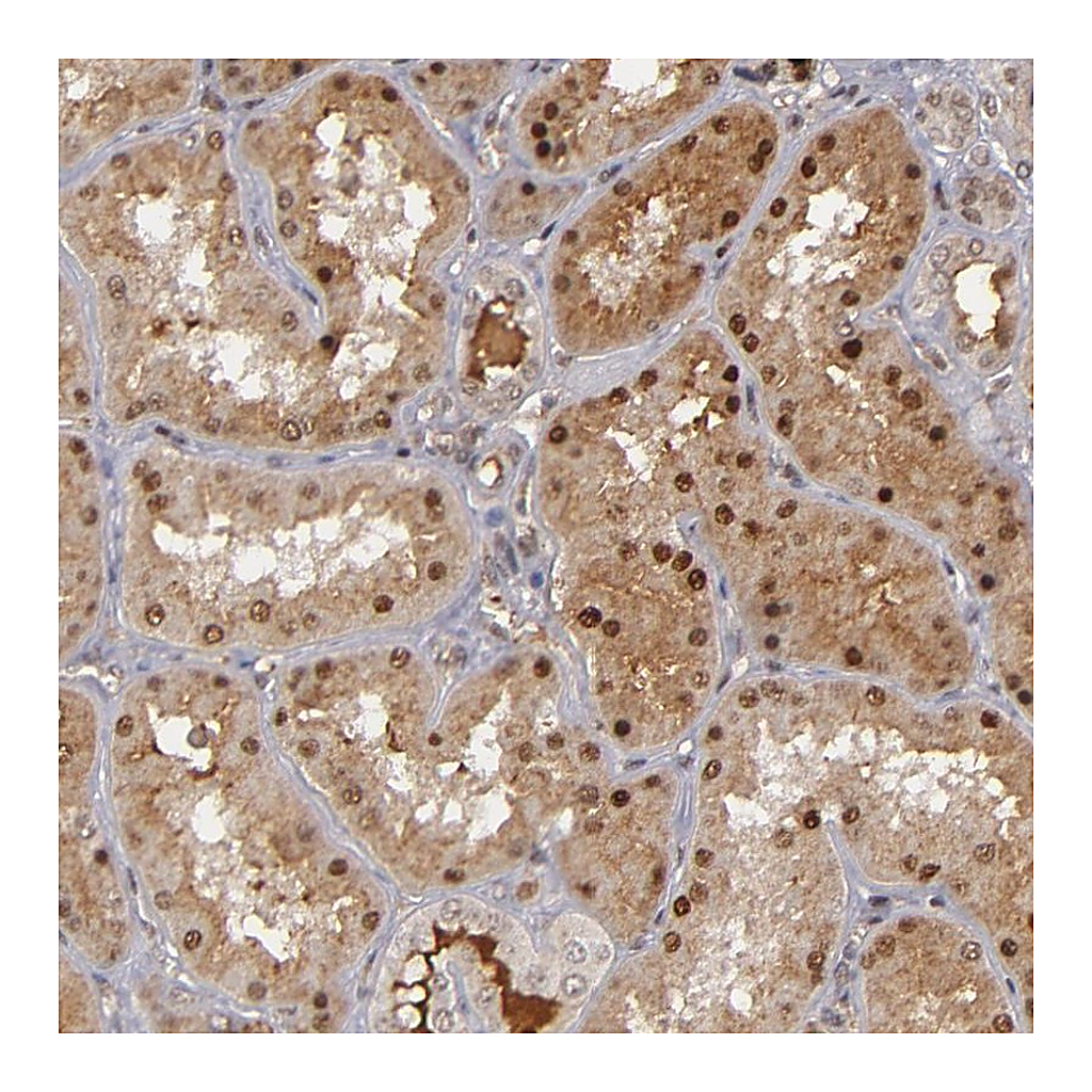 Atlas Antibodies Anti-ZNF234 Antibody