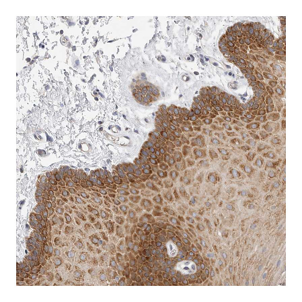 Atlas Antibodies Anti-ZNF23 Antibody