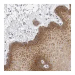 Atlas Antibodies Anti-ZNF23 Antibody
