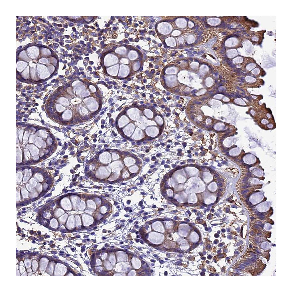 Atlas Antibodies Anti-ZNF235 Antibody