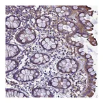 Atlas Antibodies Anti-ZNF235 Antibody