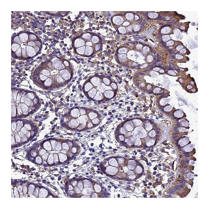 Atlas Antibodies Anti-ZNF235 Antibody