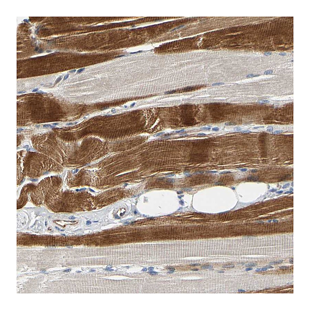 Atlas Antibodies Anti-ZNF236 Antibody