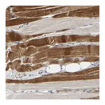 Atlas Antibodies Anti-ZNF236 Antibody