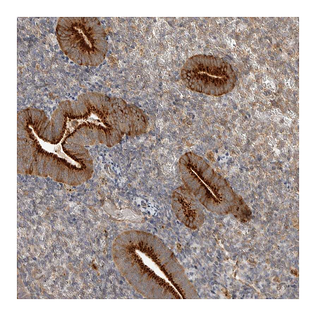 Atlas Antibodies Anti-ZNF232 Antibody