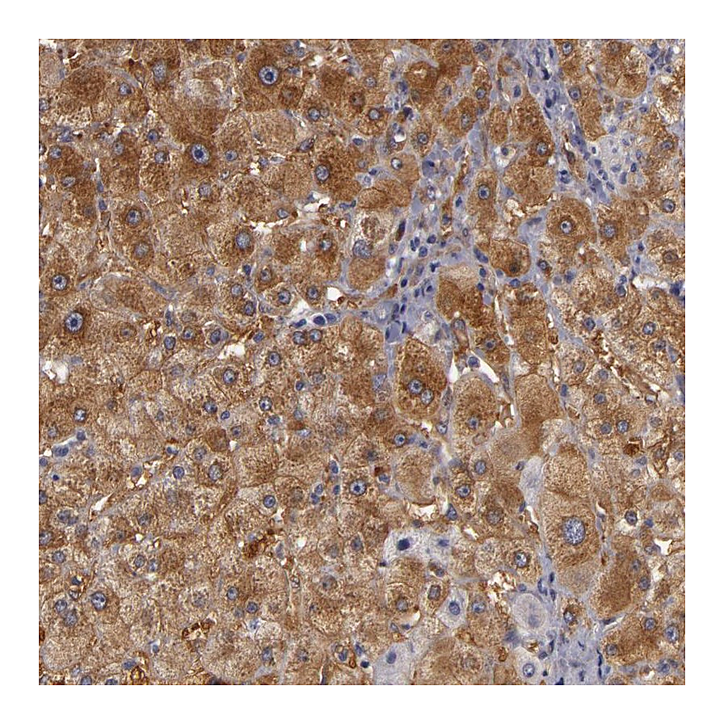 Atlas Antibodies Anti-ZNF229 Antibody